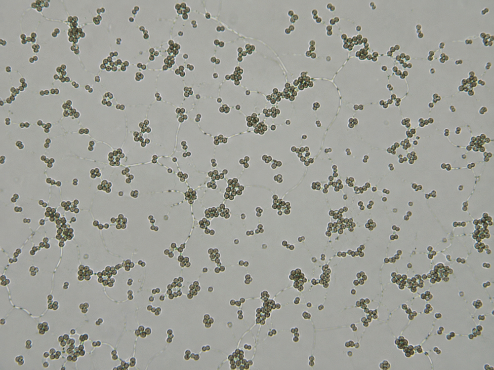 Azotobacter chroococcum