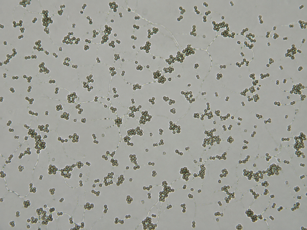 Azotobacter chroococcum