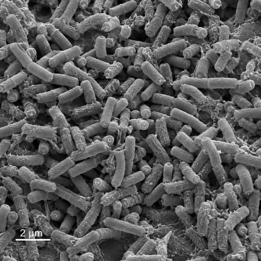 Bacillus subtilis