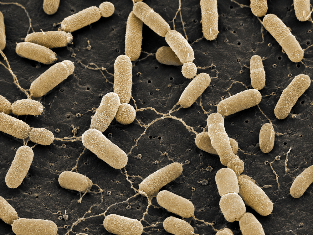 Gluconacetobacter diazotrophicus
