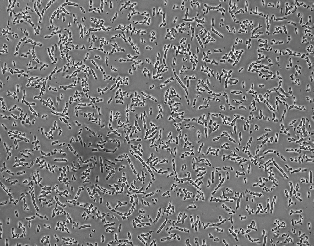 Pseudomonas putida