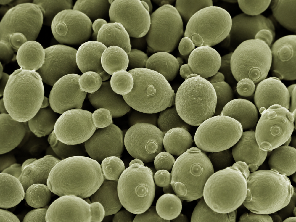 Saccharomyces cerevisiae