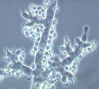 Trichoderma harzianum