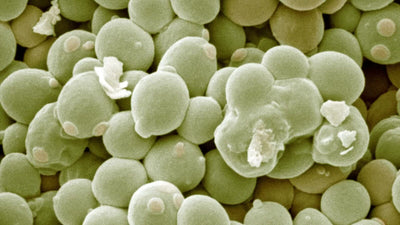 Saccharomyces cerevisiae